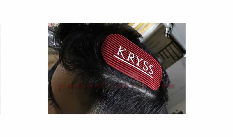 Kryss Saç Düşme Önleyici Saç Tutucu (saç Cırtı) - Thumbnail